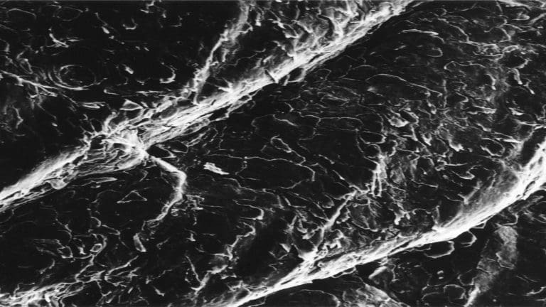 How AI Helps in Whole Slide Images Analysis for Cancer Detection How AI Helps in Whole Slide Images Analysis for Cancer Detection